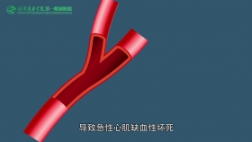 醫(yī)院胸痛中心動(dòng)漫